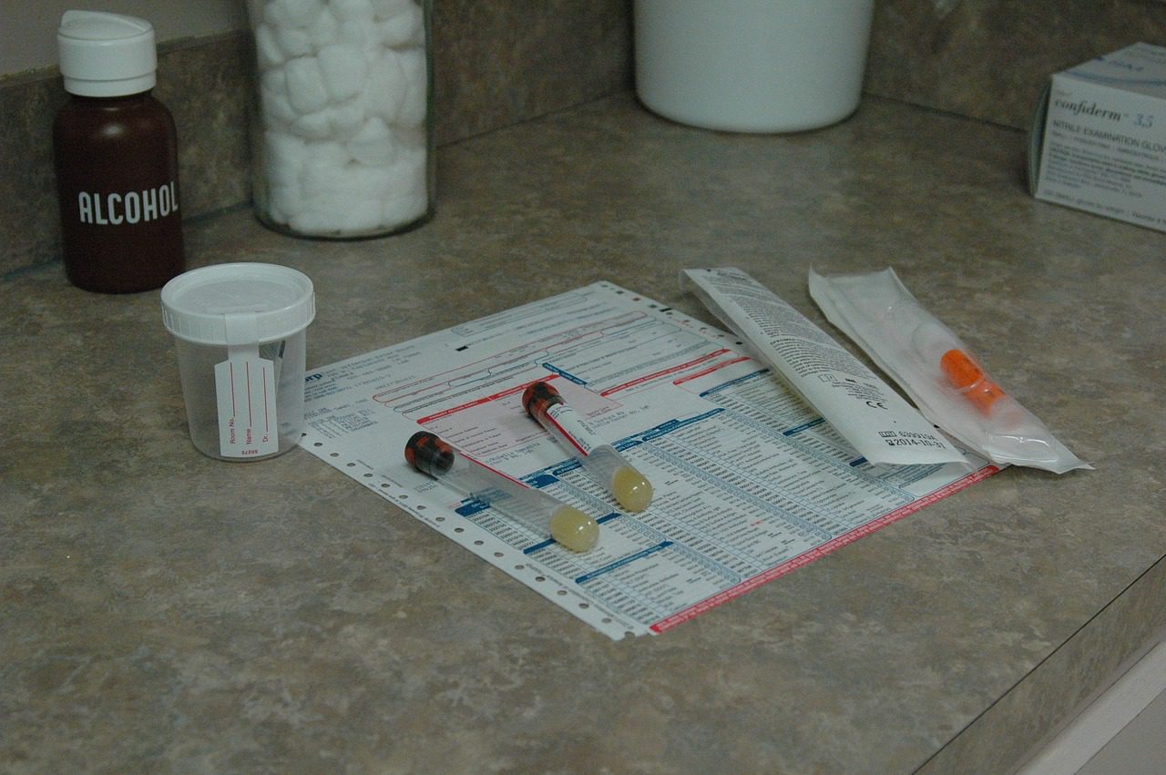 test ovulation