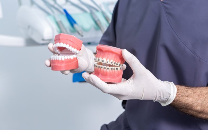 Crop anonymous stomatologist with dentures sitting in clinic